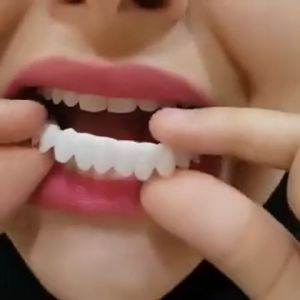 Promo Snap On Smile Asli 100% Autentik untuk Gigi Palsu Snap N Smile