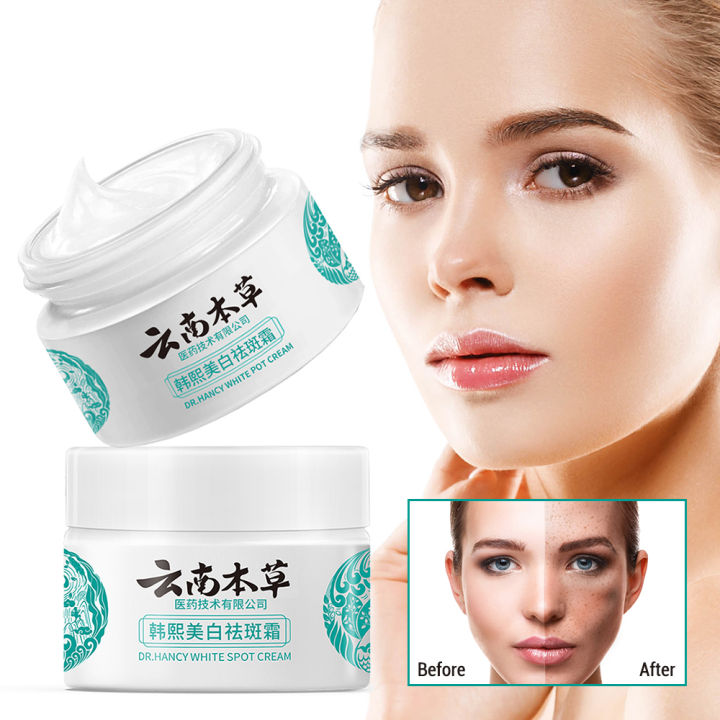 Whitening Freckle Cream Arbutin Niacinamide Remove Melasma Dark Spots ...