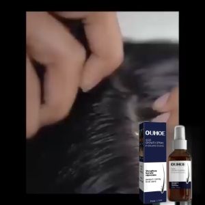 OUHOE Natural Hair Growth Spray Hair Growth Oil Hair Regrowth Serum Volumizing Thickness Hair Lotion Spray Anti-Hair Loss For Men And Women(50ml)