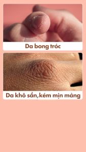 (Chính Hãng) Kem Dưỡng Da Tay Giữ Ẩm Bơ Hạt Mỡ Palmers 96G