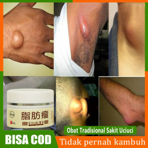 obat lipoma benjolan paling ampuh Obat benjolan di leher Lipoma Herbal Benjolan Lipoma Penghilang Benjolan di Tubuh Kelenjar Getah Bening Penghancur Benjolan Lipoma Propolis