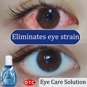 Eye Drops for Eye Care15ml/Brand Eye Drops/mineral eyedrops/Eye Drops Artificial Tears Improve Eyesight Eye Drops Itchy Eyes Lubricant & Rewetting Eye Drops Dry Eye Visual Fatigue Relieve and Protect Eyesight 本草眼滴液 视力王熊胆液 滴眼液 眼痒 缓解眼睛疲劳 护眼 护眼液 眼睛干涩