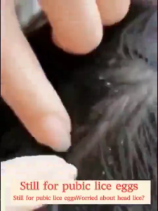 Shampo Kutu Rambut Anak dan Dewasa shampo anti kutu bio herbal shampo kutu rambut kutu kepala rambut alami shampo penghilang kutu rambut Obat kutu-120ml