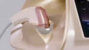 Professional Commercial Beauty Device 12D Hifu Face Lifting Neck Lift Body Slim Facial Lifting Weight Loss Anti-wrinkle Taief MPT 22D Max Hifu