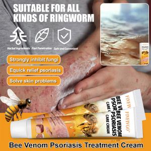 Propolis Extract Skin Care: Relief & Moisturization for Itchy Hands & Feet