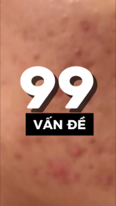 [TEM PHỤ + VAT] Kem retinol KyungLab Alab Cream tái tạo trẻ hoá da ngăn ngừa lão hoá 30ml