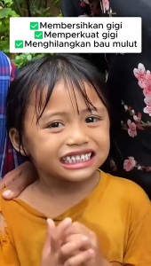 SP-7 Teeth Whitening Toothpaste 120g Pemutih Gigi Kuning Removal Tartar Bad Breath Removal Yellow Stains Fresh Breath Protecting Oral Health