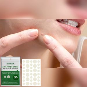 Acne Pimple Sticker Promote Acne Growth Secretion Absorption Invisible Acne Cover Face Spot Help Wound Anti-Inflammatory