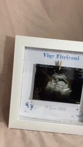 Pigura / frame 3d USG Baby Photo Frame