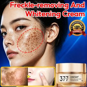Cream Dark Spot 30g 377 Dark Spot Remover Cream remove Melasma Degil Penghilang Flek Hitam Cepat 377美白淡斑面霜
