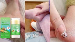 Son Dưỡng Tay Và Chân Cỡ Du Lịch Với Sáp Ong Phục Hồi Da Khô Nứt Nẻ Không Nhờn Rít Làm Dịu Gót Chân Và Chăm Sóc Tay 30g