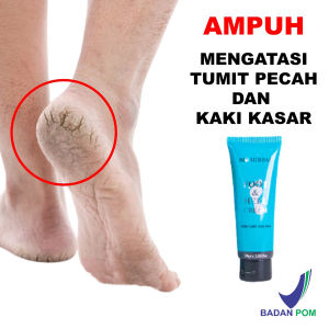 Obat Kaki Pecah2 dan Kering Parah BPOM Mabrem Krim Kaki Salep Rorombeheun Gatal Untuk Cream Tumit Serbaguna