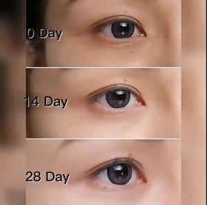 🔥Cadia👍 100% Original Caviar Eyebags Remover Eyebags And Wrinkles Remover Eye Cream & Serum Bag Dark Circle Anti Puffiness Gel Firming Brighten Retinol Cream 20g