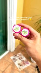VERDEFY Keloid & Stretch Mark Remover Cream Scar Remover Cream MIRACLE CREAM PEKLAT CREAM