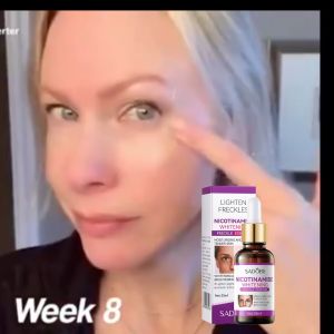 BUY 1  TAKE 1 Niacinamide Whitening and Anti-spot Essence Effectively Removes Chloasma and White Spots Whitening Essence Moisturizing and Anti-aging Removes Dark Spots and Wrinkles Brightening Skin Essence Softens Pores Collagen Facial Essence 30ML