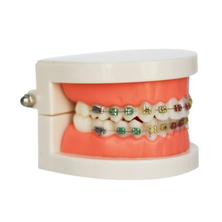 Dental Orthodontic Teeth Model with Colorful Braces Standard Denture ...