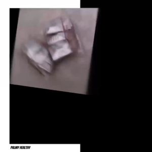Obat Sakit Gigi Terbaik - Solusi Ampuh dan Terpercaya untuk Meredakan Nyeri Gigi dengan Efektif