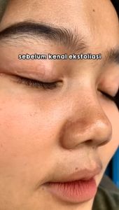 Skin nice 30 Exfoliating Gel 50ml All Skin types mengangkat sel kulit mati penghilang daki BPOM viral