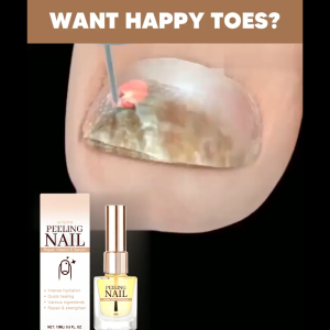 nail repair treatment，AMELIE&&Jaysuing+Hands Feet Nails Nail Surface Repair Rotten Nail Nail Growth Fungus Nail Care Liquid