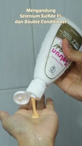 Selsun Gold 120ml: Solusi Terbaik untuk Mengatasi Ketombe
