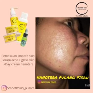 SMOOTHSKIN: Solusi Perawatan Kulit Sehari-hari
