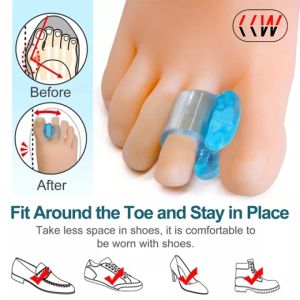 CCW 2 PCS Silicone Gel Thumb Corrector Bunion Little Toe Protector Separator Hallux Valgus Finger Straightener Foot Care Relief Pads