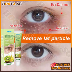 ✅SG stock✅ Milia seed remover / Fat granules remover eye cream / Milia removal eye cream / Milia seed removal cream / 去除脂肪粒 眼霜