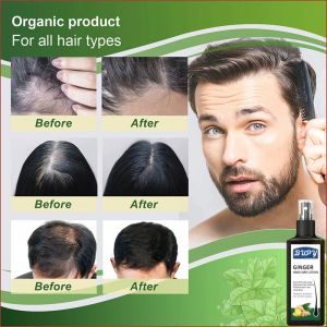 Hair growth spray to prevent hair loss and baldness can also increase hair growth and dense hair spray 120ml