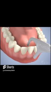 Tăm chỉ nha khoa Coral Enfresh Oral bịch 50 cái