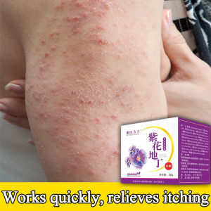 Skin antibacterial cream Original Product Anti-itch antibacterial Cream 30g herbal skin cream，psoriasis eczema treatment，Easily repair various skin infections Itching cream Anti-peeling