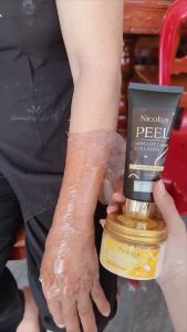 [Chính Hãng] Combo Kem Nicolas Peel Lột Lạnh Thanh Nhi + Kem Body Cấy Trắng Men Chua Nicolas Cosmetic