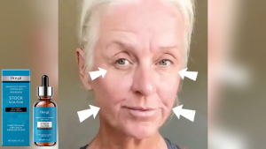 โรจูคิส เซรั่มบำรุงผิวหน้า ลดเลือนริ้วรอยรอบดวงตา ให้ผิวชุ่มชื้น กระจ่างใส Rinsran