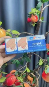 Kem Tr..ị Đồi Mồi Tay Kpem Nga 50ml