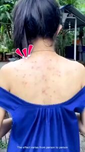 Sulfur Soap Sabun Mandi Gatal Belerang Sangat AMPUH atasi Kulit Eksim PANU KADAS KURAP Jamur Alergi Shanghai