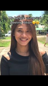 SCD Peeling Skin Lotion 100ml Big or 50ml Small Niacinamide Peeling Lotion Skin Care For Face & Body Whitening Original