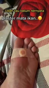 Plester Penghilang Mata Ikan Kapalan Foot Corn Removal Obat Basmi Kutil