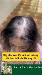 Dầu Gội Chống Rụng Kích thích Mọc Tóc ELBON - Dầu Gội Thảo Dược 5 Trong 1 Hàn Quốc Giúp Giảm Rụng Hết Hói Đầu