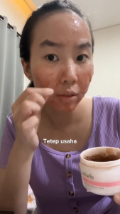 POLYNIA | Shiconix Soothing Moisture Face Mask | Rawat Jerawat Meradang | Tenangkan kulit Kemerahan | Kulit Senstif dan Iritasi