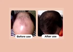 Aleya Shampoo Extract Ginseng 250 ml - Solusi Anti Hair Fall