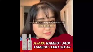 JIANLAB Hair Treatment Serum bantu Tumbuhkan rambut yang sudah botak atau kebotakan dini rontok