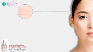 เซรั่มบำรุงผิว NMP CONCENTRATE ANTI WRINKLE SERUM พร้อมส่ง สินค้าขายดี