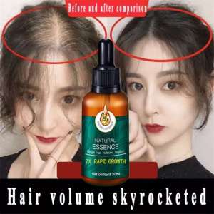 EELHOE Hair Growth Serum: Penumbuh Rambut Cair 30ml