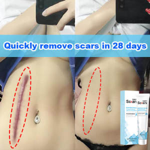 Scar remover cream 祛疤膏 scar gel  Remove Stretch Marks acne scar For Old Scar On Leg Repair Damaged Skin，burn/surgery keloid/laparotomy/Raised Sca Diminishing Melanin Scar And Let Skin Re-grow