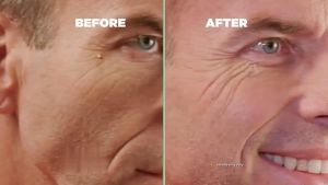 Skin tag remover cream Warts removal cream Corn Removal 20g Antibacterial Foot Warts Hand Warts Corn Skin Tag Warts Remover