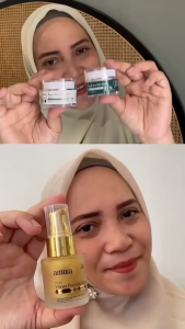 Amura Paket Flek Hitam - Spesialis Atasi Flek Hitam Garis Halus & Kulit Kusam - Menyamarkan Flek Hitam Membandel Menyamarkan Garis Halus di Wajah Menyamarkan Pori Pori Wajah Mencerahkan Wajah dan Glowing Menyamarkan Bekas Jerawat Hitam