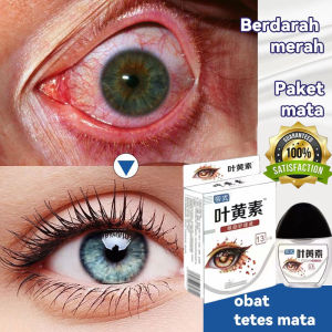 eye drop ubat mata selaput lutein eye supplement obat mata katarak eye care spek rabun dekat dan silau mata merah 眼药水干涩