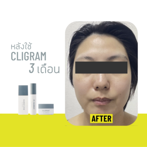 CLIGRAM KOJIBRIGHT 5G. คลิแกรม โคจิไบรท์