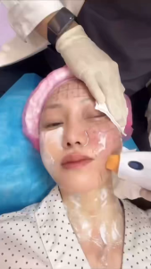 Face Lift Facial Wrinkle Removal and Body Slimming Radiofrequency Beauty Machine