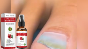 West Month Nail Care Oil Anti-Nail Groove Safety Repair Toenail Treatment Oil Anti Bacterial Toenail Repair Liquid 30ml