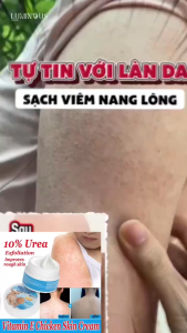 Set 3 Hộp Kem Dưỡng Ẩm Làm Mềm Da Toàn Thân Chứa Urea 10% Và Vitamin E Giúp Làm Mịn Da Sần Sùi Dưỡng Trắng Da Khô Hiệu Quả Và An Toàn